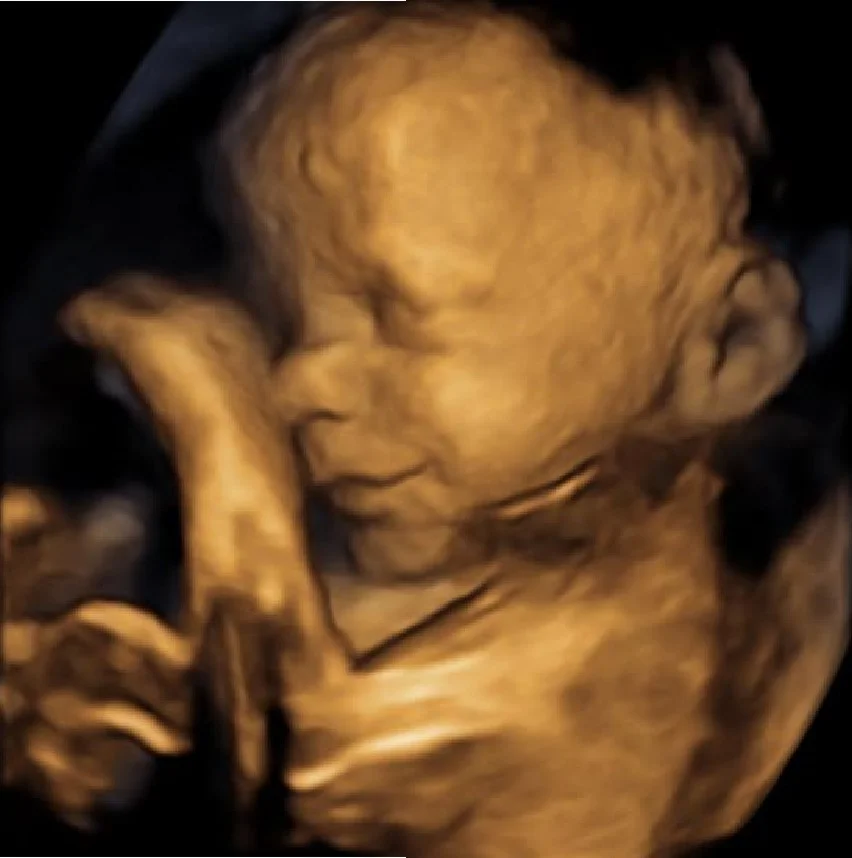 4d and 3d fetal ultrasound third trimester