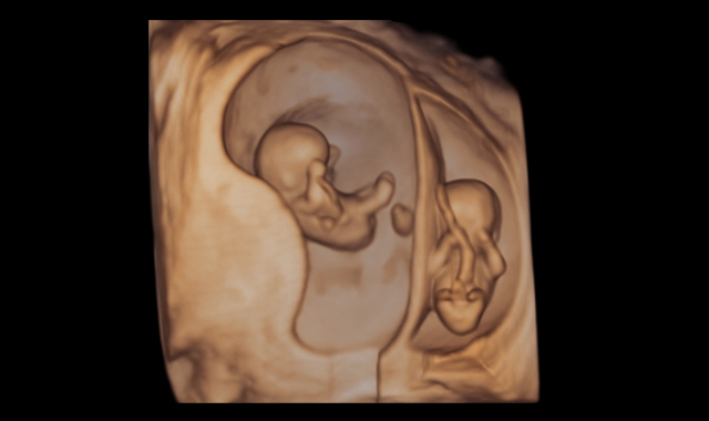 ultrasound-care-feature-box-04.2.jpg