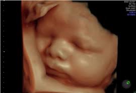 4d third trimester.jpeg