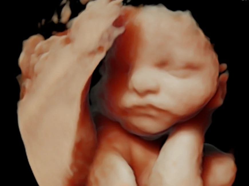 4D HD Live Third Trimester