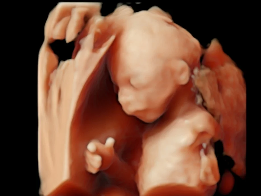 19 week fetus ultrasound 4D HD Live 5D