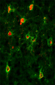 This shows cells of the auditory cortex from a young mouse. Cells can be parvalbumin positive (red), or perineuronal positive (green), or have both parvalbumin and perineuronal nets (red surrounded by green). In our paper we show that all three cell types decline with presbycusis. These changes can cause functional deficit in auditory processing.