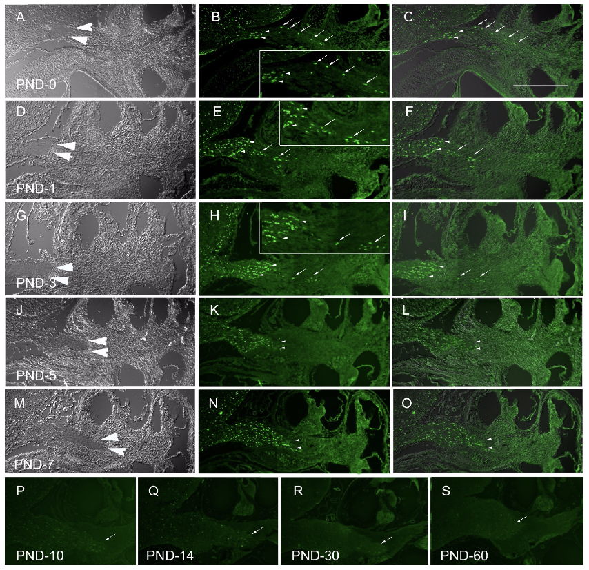 The immunoreactivity of Olig2 was detected during postnatal day (PND) 0 to 7, which became weaker after PND 10. Before PND 7, the majority of Olig2-expressing cells were found within the modiolus at the basal cochlear turn, while a few cells were located peripherally to the DIC-PCTZ and in close proximity to the spiral lamina at the basal cochlea turn. After PND 7, Olig2-expressing cells were fully overlapped with the DIC-PCTZ within modiolus at the spiral lamina in the basal cochlea.