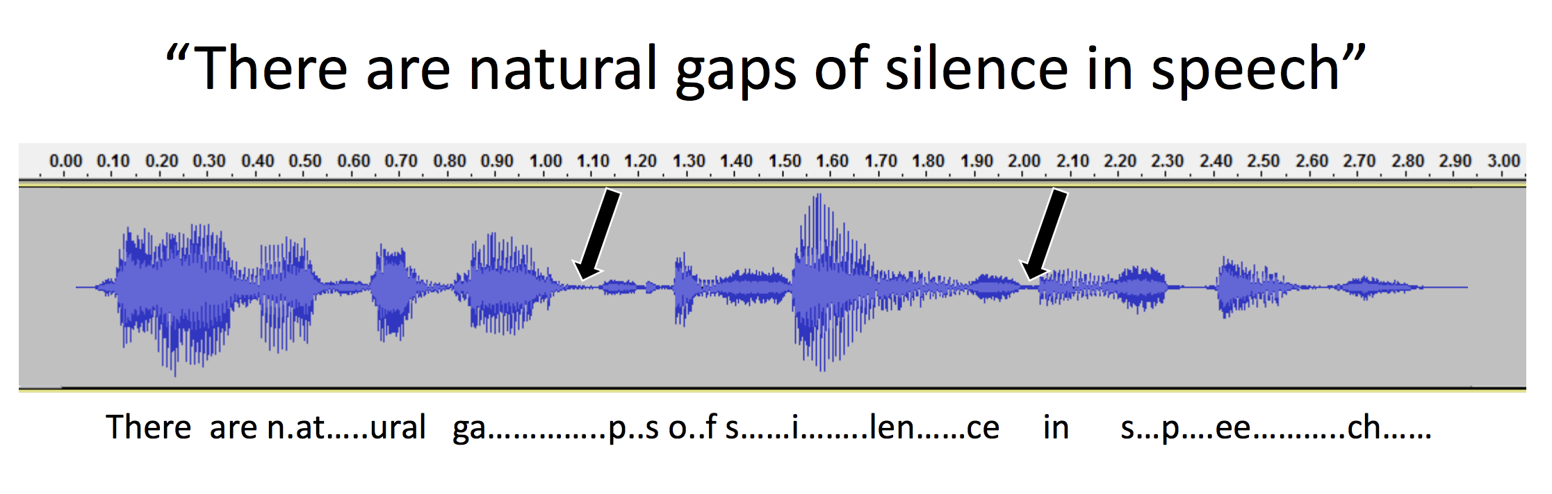 This digital oscilloscope representation of speech, with pauses, shows that gaps as short as a few milliseconds are used to separate words and syllables. According to Frank Musiek, Ph.D., CCC-A, a professor of speech, language and hearing sciences at the University of Arizona, people with some kinds of hearing difficulties require longer than normal gap intervals in order to perceive them. Credit: Frank Musiek