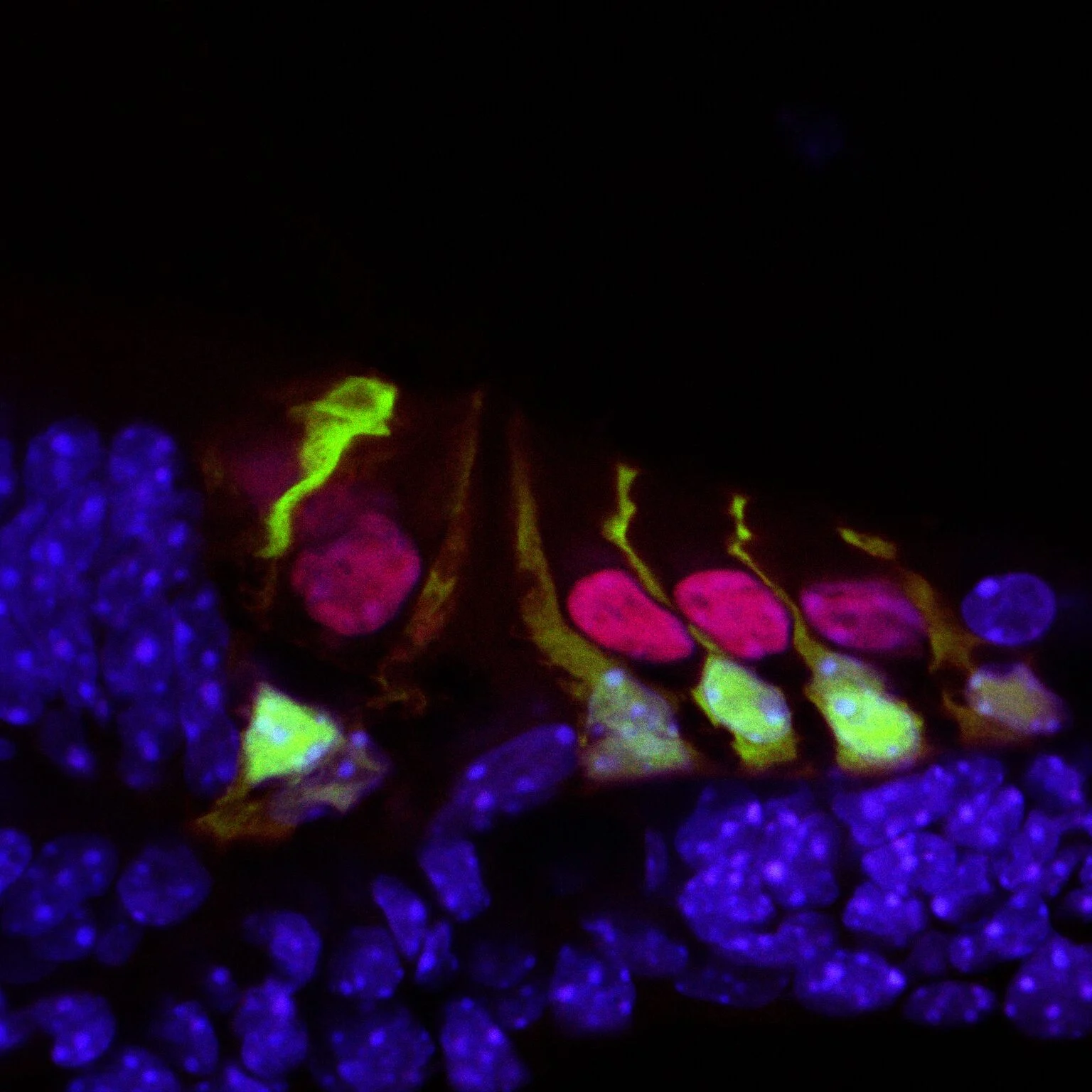 Hair cells in the mouse cochlea courtesy of the lab of Hearing Restoration Project (HRP) member Andy Groves, Ph.D., Baylor College of Medicine.