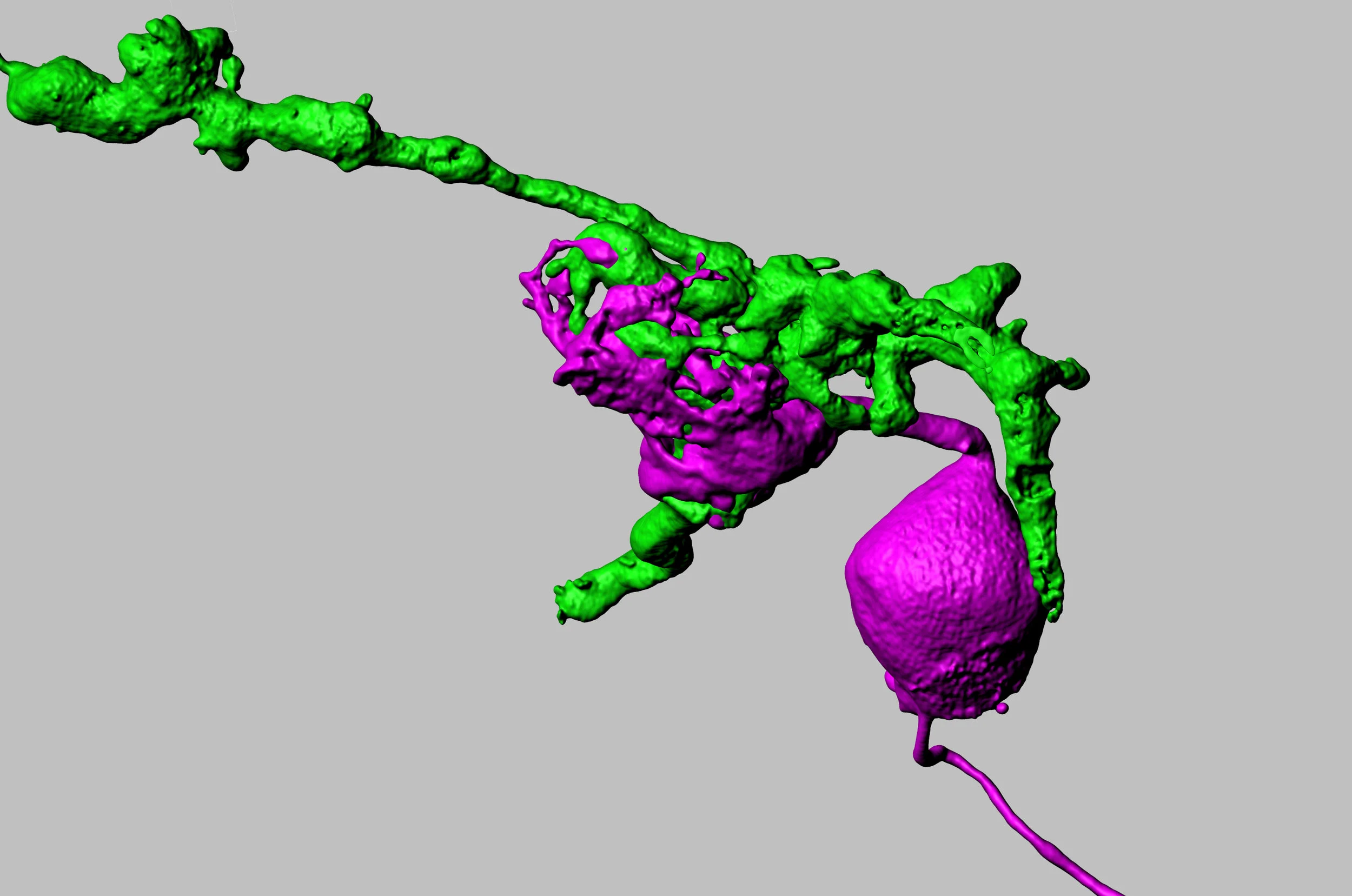 Balmer & Trussell traced the direct and indirect pathways that carry vestibular information to the cerebellum for controlling balance and posture. Shown here is a primary afferent axon (green) expressing the light-gated ion channel, Channelrhodopsin. Postsynaptic cells, in this case a unipolar brush cell (magenta), were recorded from during stimulation of the input axons by light flashes. This technique was used to discover how direct and indirect vestibular pathways are processed in the cerebellum.