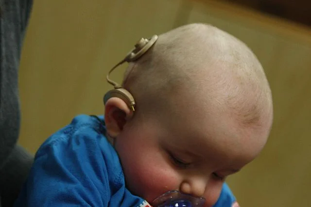 Infant_with_cochlear_implant.jpg