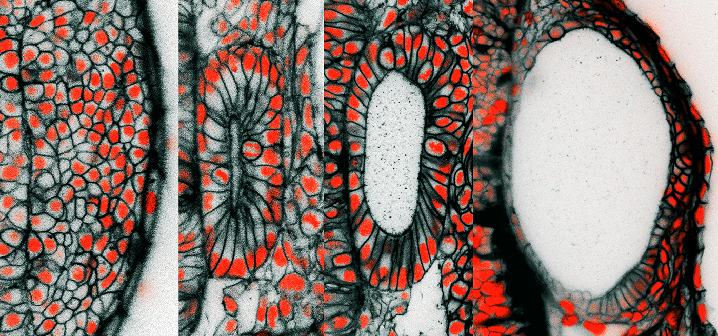 These are cross-sectional pictures from live 3D microscopic images of the developing zebrafish ear. The images are from time-points at 12, 16, 24, and 45 hours after egg fertilization, a span of time during which the ear rudiment grows more than four times in volume. The black coloring is a fluorescent protein targeted to the outer membrane of individual cells. The red is from a fluorescent protein targeted to the nucleus of individual cells where it binds to DNA. At 45 hours post-fertilization, the length of the embryonic ear’s long axis is approximately 1/10th the thickness of a penny.