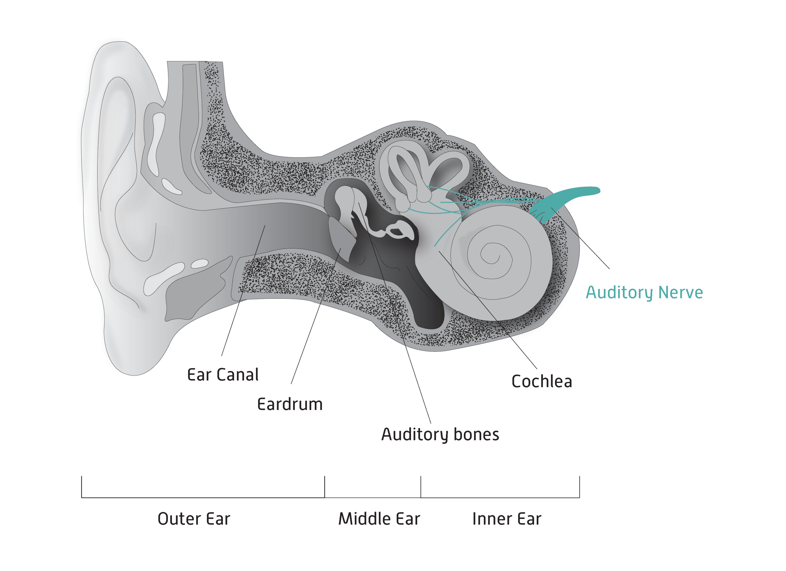 Types of Hearing Loss — Hearing Health Foundation