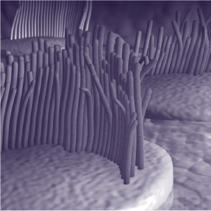 Damaged hair cells.