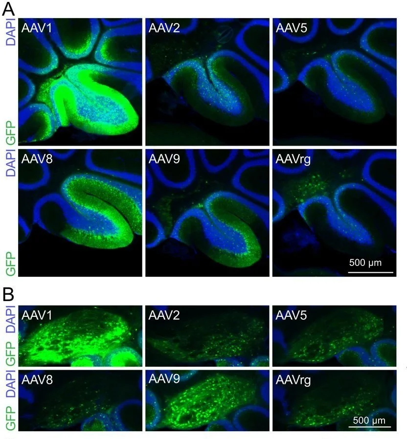 Analysis of Six Gene Delivery Methods in the Mouse Model — Hearing ...
