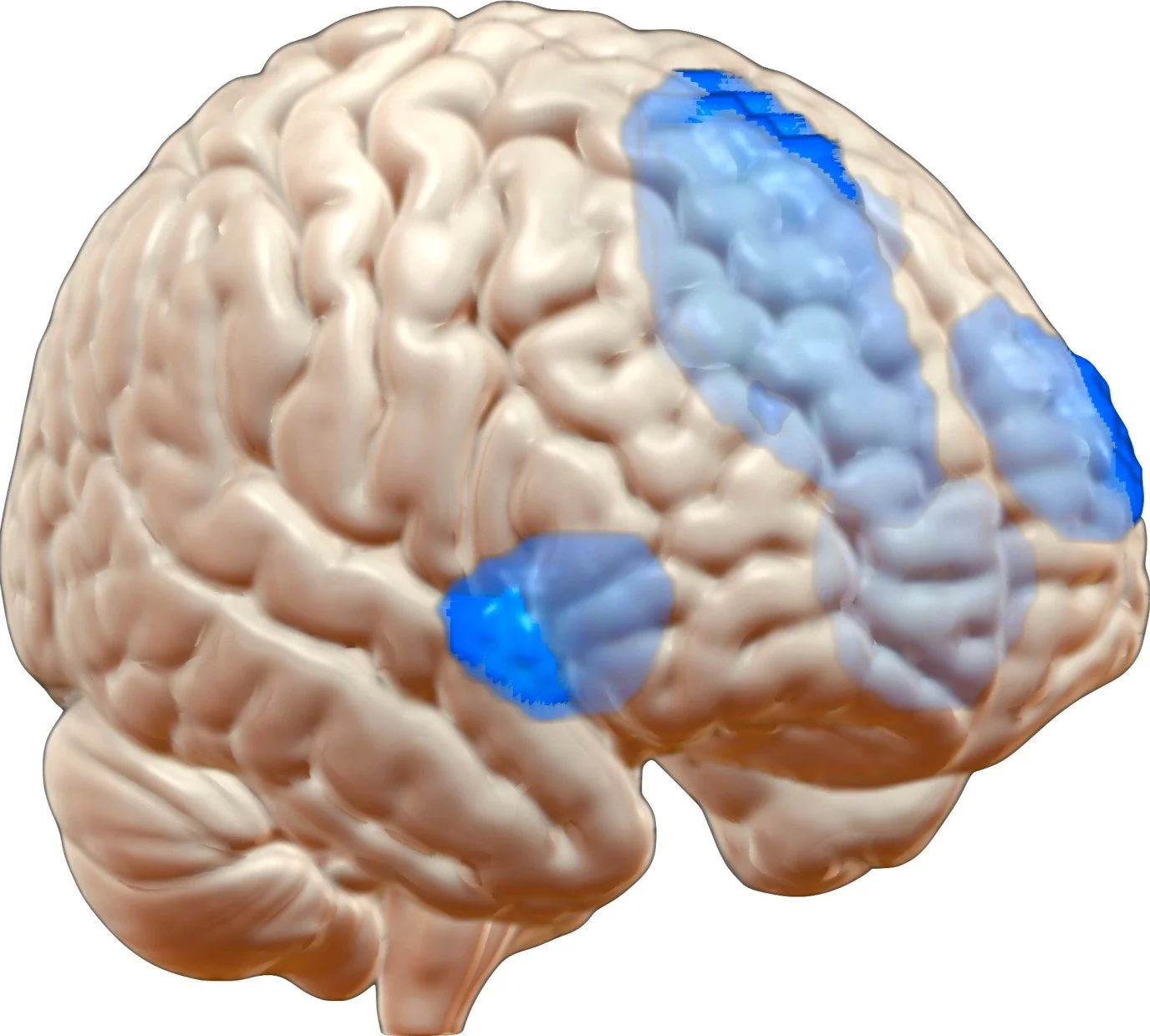 What Is the Cingulo-Opercular Network? — Hearing Health Foundation
