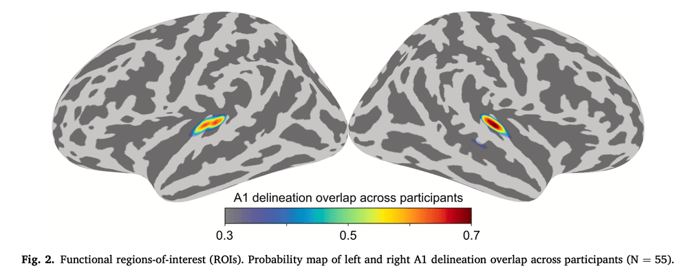 Brain Connectivity Patterns in Children With Autism Spectrum Disorder ...