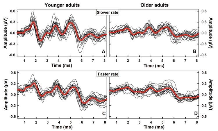 Complexity Behind Why Hearing in Noise Gets Harder With Age — Hearing ...