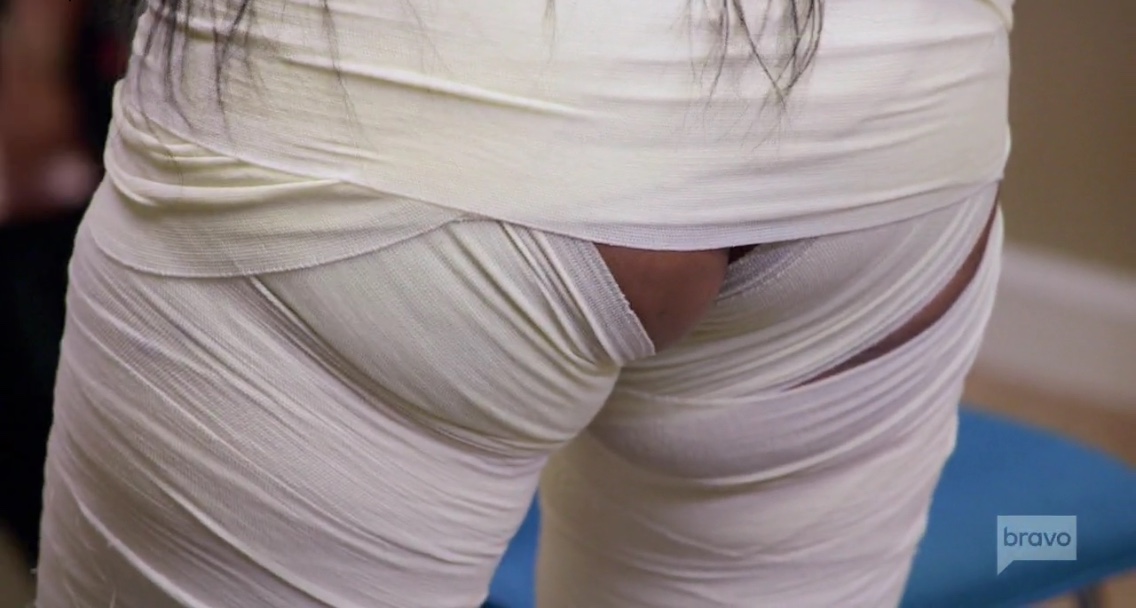 butt cheeck.jpg