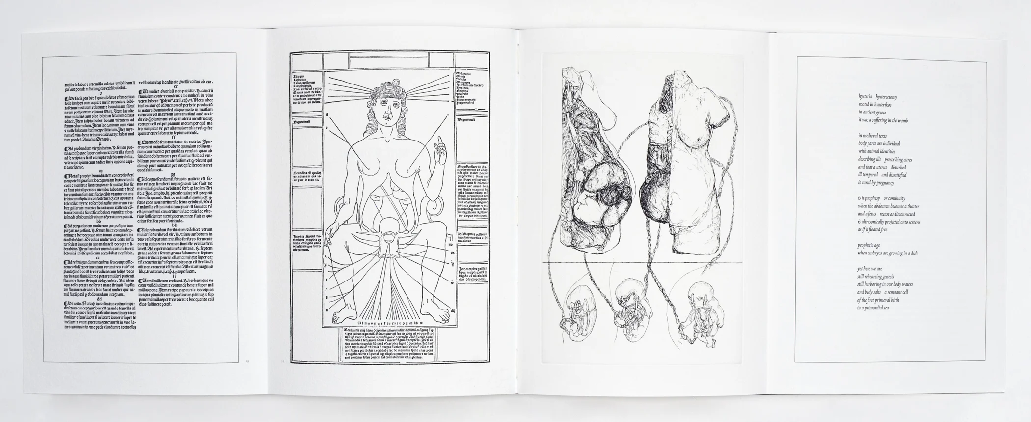 Anatomy_Lesson_PregWoman-open_300@7%22_MRM9289.jpg