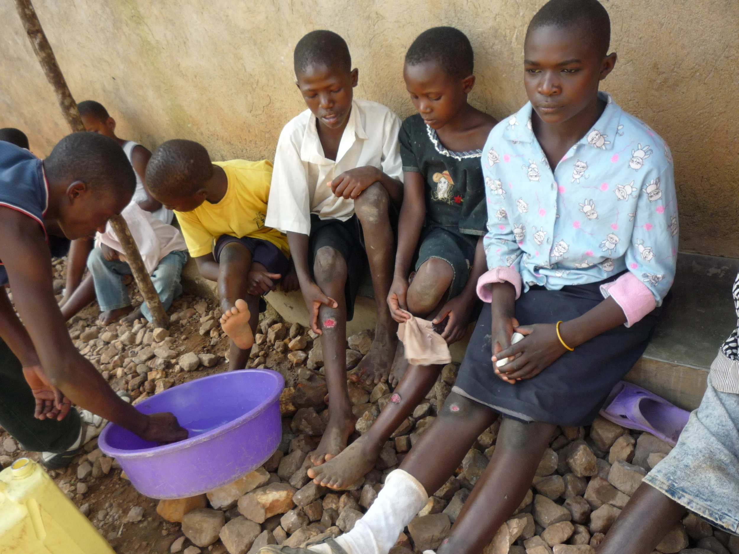 A simple first aid kit can stop infections from mosquito bites escalating into severe ulcers..