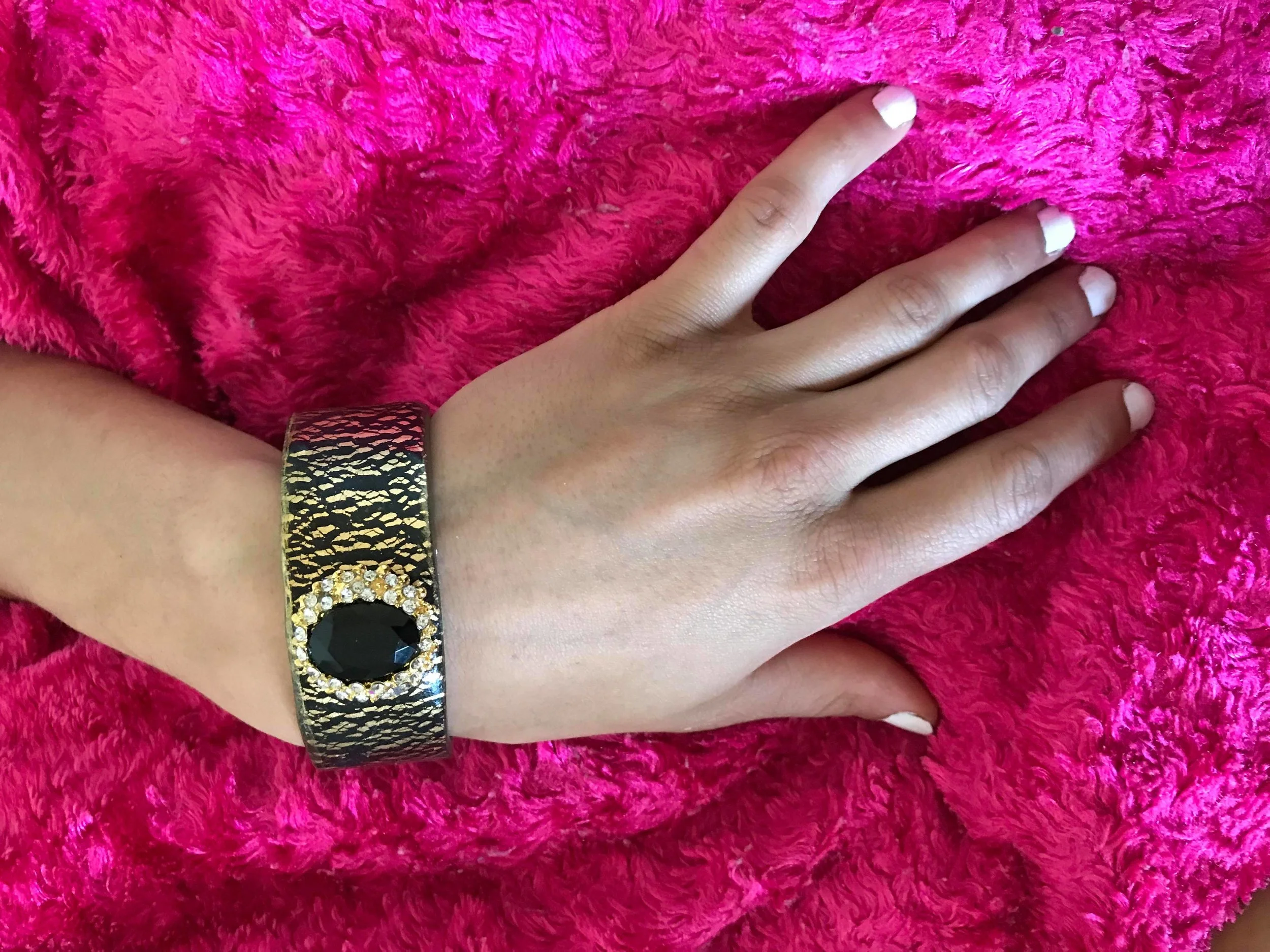nyciabraconwrist2.jpg