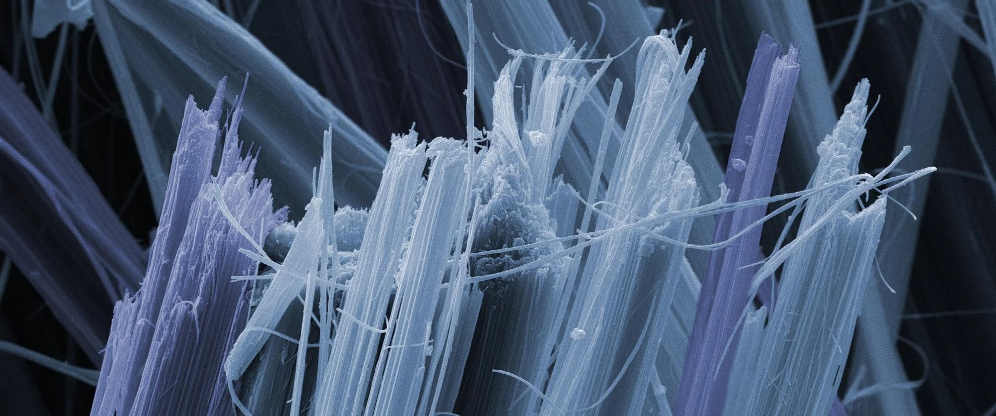Microscopic picture of asbestos fibers. From: https://www.chemistryworld.com/news/why-asbestos-is-still-used-around-the-world/3007504.article