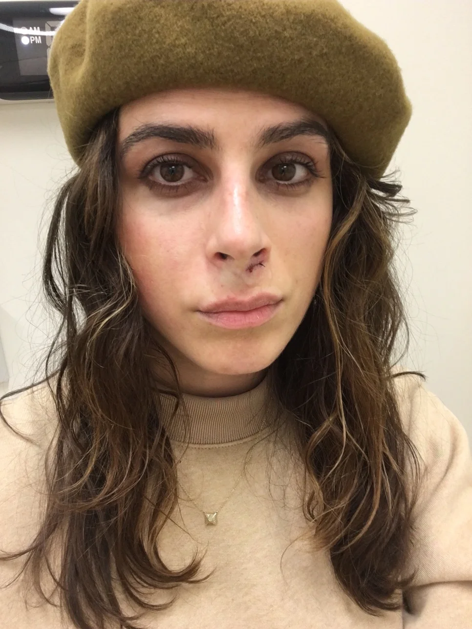 cedars-sinai célfie