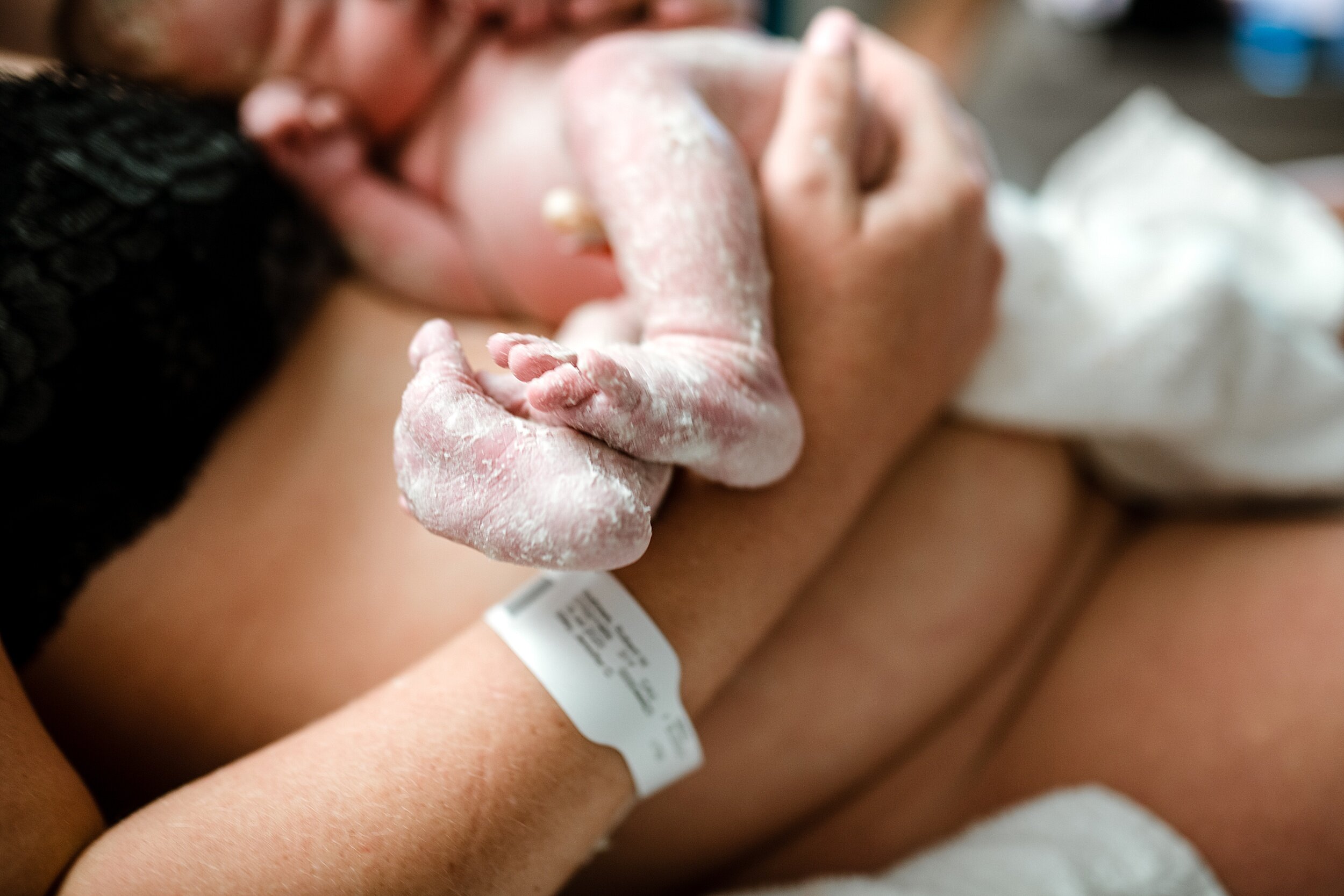 what-is-vernix
