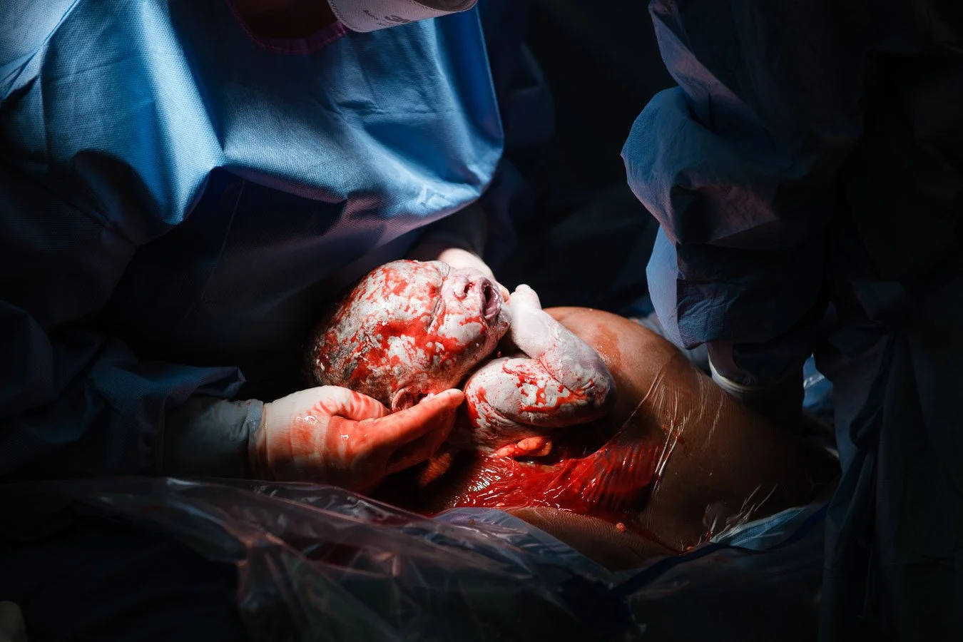 When the OB/GYN is my friend &amp; client, and I know, that she knows, that I know to move around the OR with a careful slowness and be mindful not to get in anyone&rsquo;s way or compromise the sterile field, and I can inch in a little closer than I