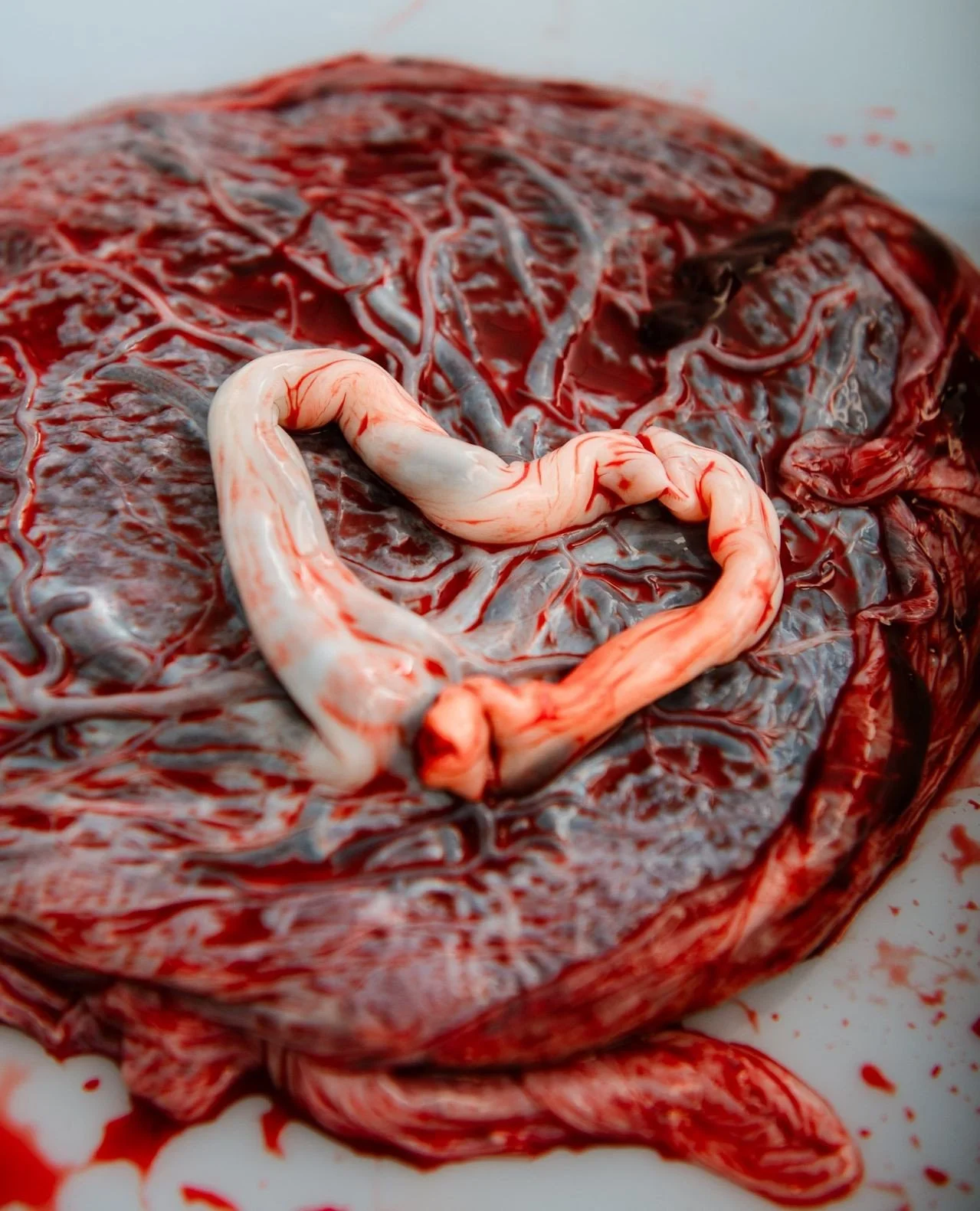 You grew an organ. Not metaphorically. Literally.⁠
⁠
A fully functional, temporary organ built from scratch to sustain human life.⁠
The placenta is one of the most extraordinary biological systems the human body creates. In less than a year, your bod