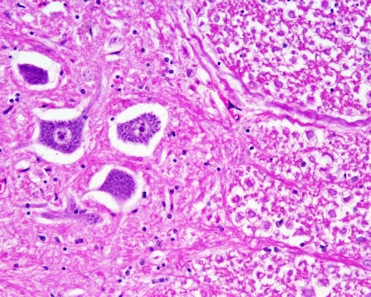 Spinal_cord_histology_08.jpg