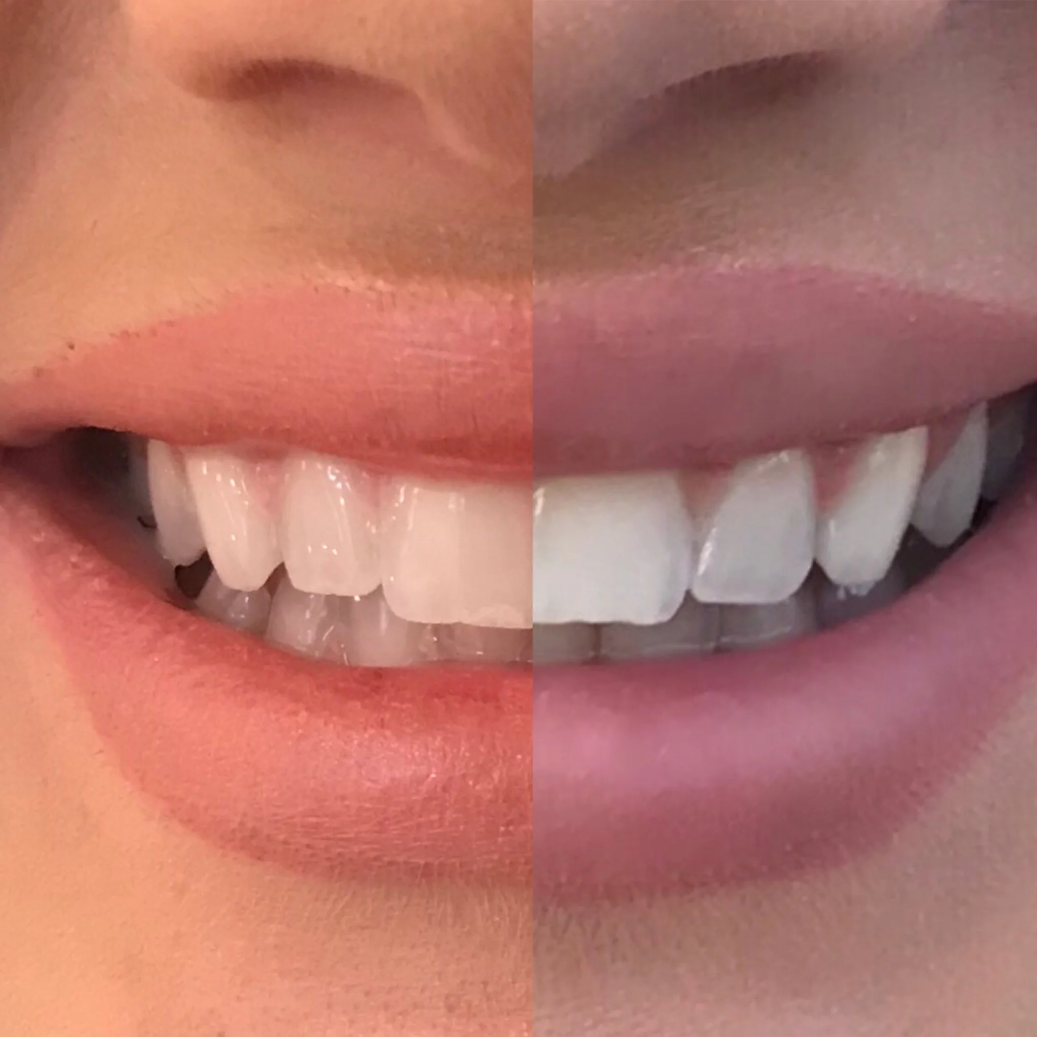 BEFORE - AFTER