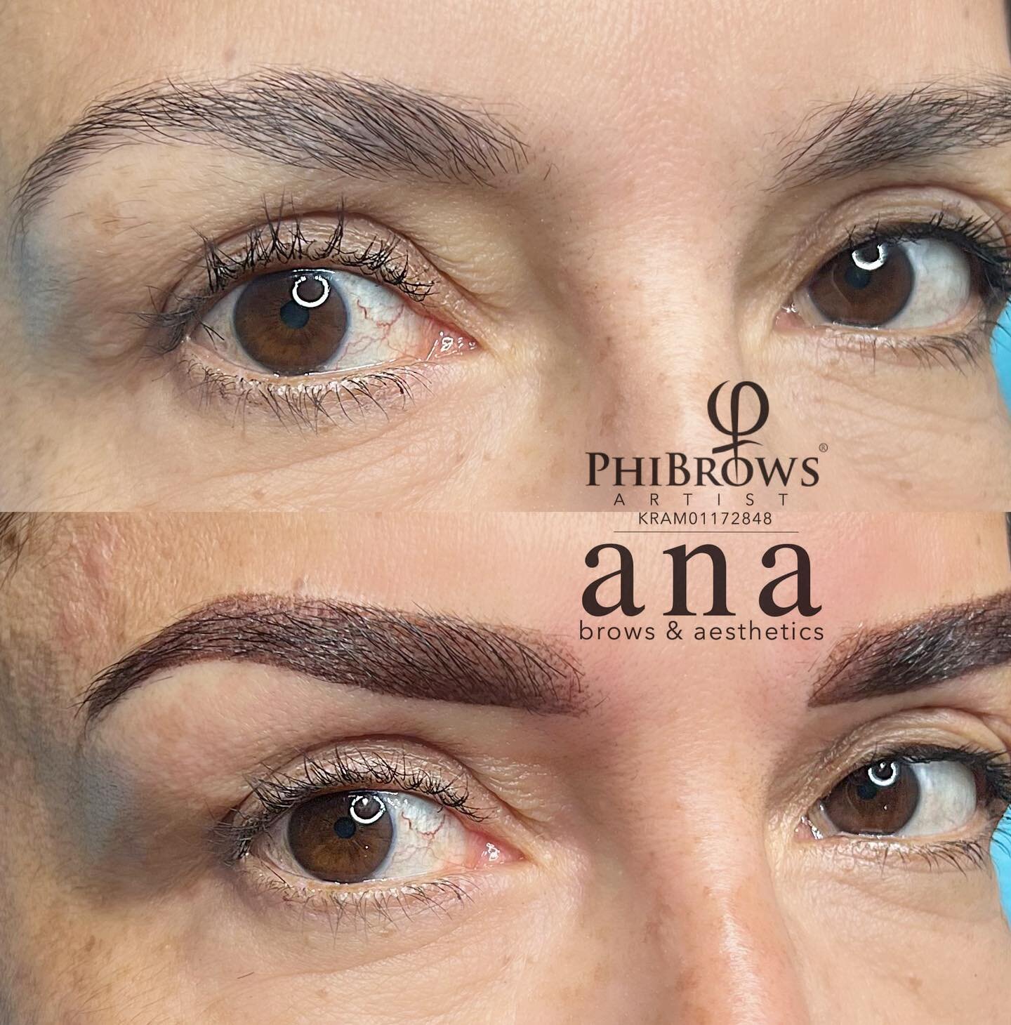 This client wanted to project a more youthful appearance. She chose to start the process with &quot;Powder Brows.&quot; Notice in the before picture her brows are thin and the arch is not defined. While they may appear dark now, over time they will s