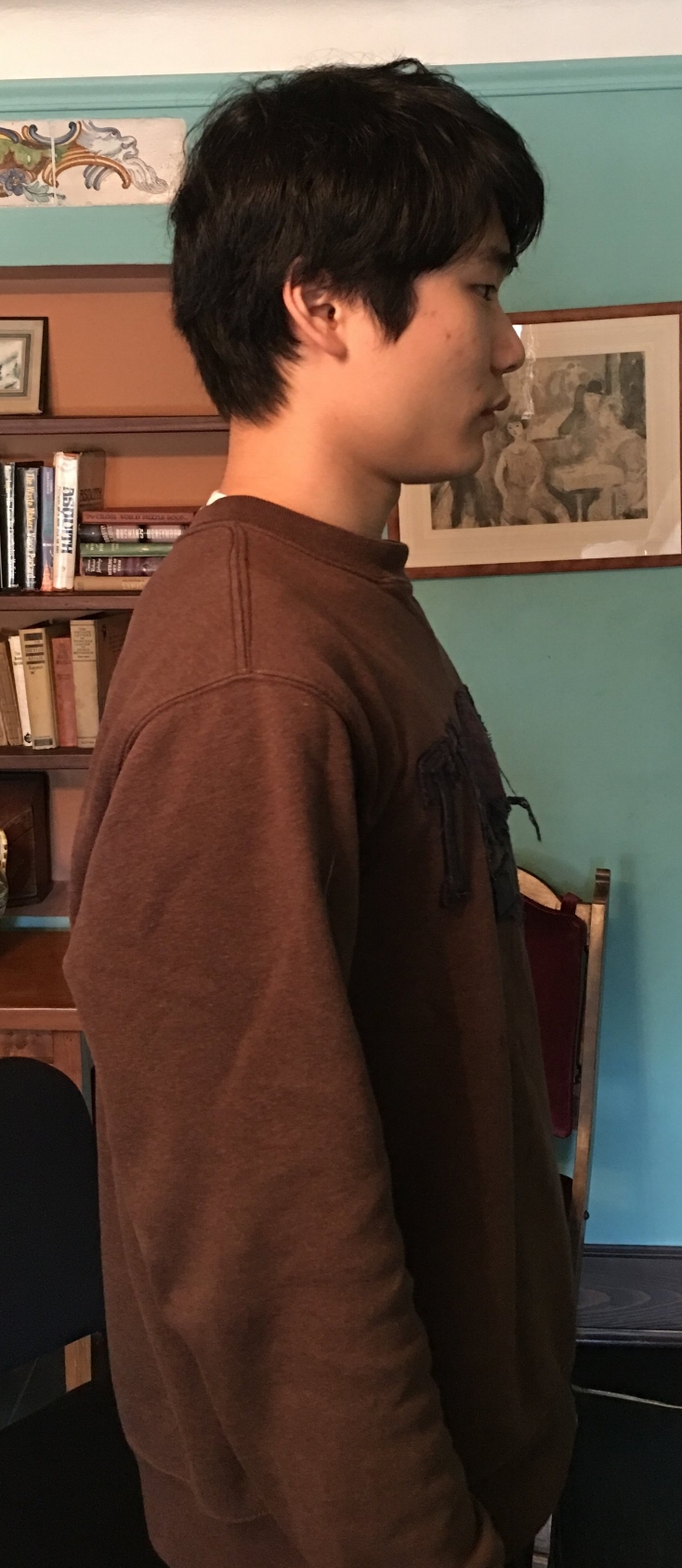  Subtle head retraction improved symptoms