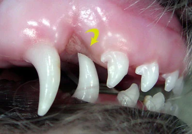 malocclusion2.jpg
