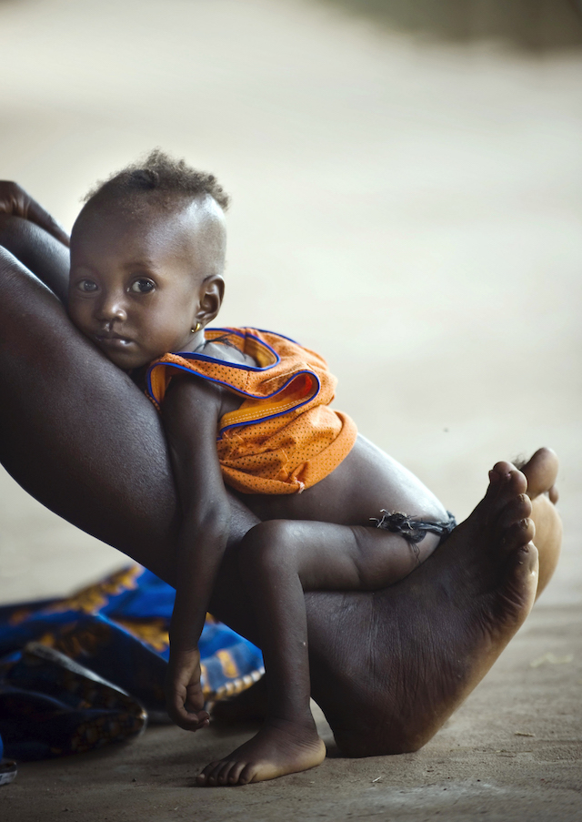 A child waits to be seen by a doctor at Kambia Hospital.