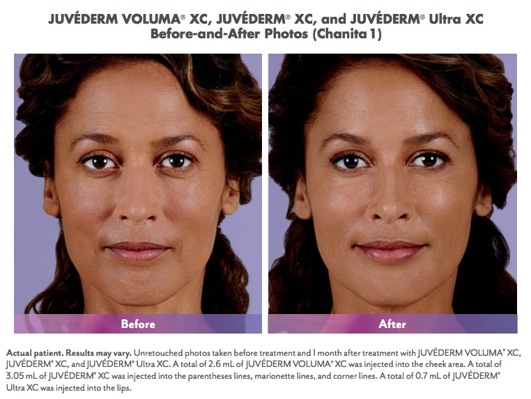 juvedermcollection2.png