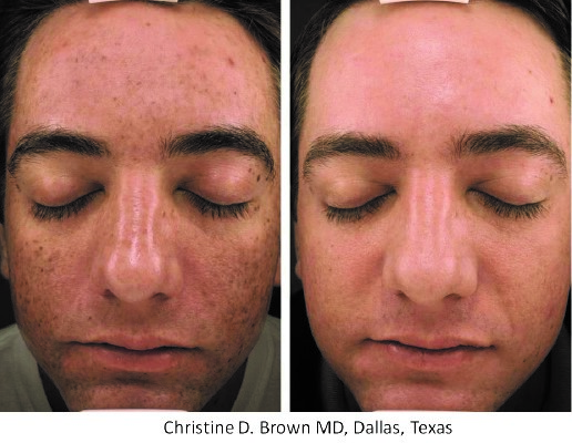 MPElite_BeforeAndAfter_Dr.-Christine-D.-Brown.jpeg