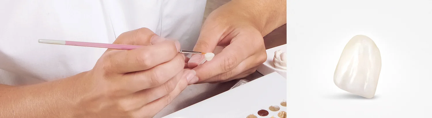 Product Catalog — Ward Dental Lab