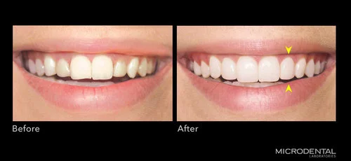 Dentistry by Dr. Anthony Ilardo, Greenwich, CT