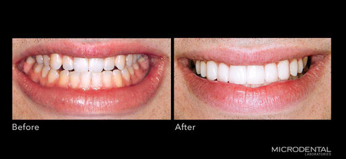 Dentistry by Dr. Harvey Ham, Wilson, NC