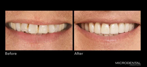 Dentistry by Dr. Michael Apa, New York, NY