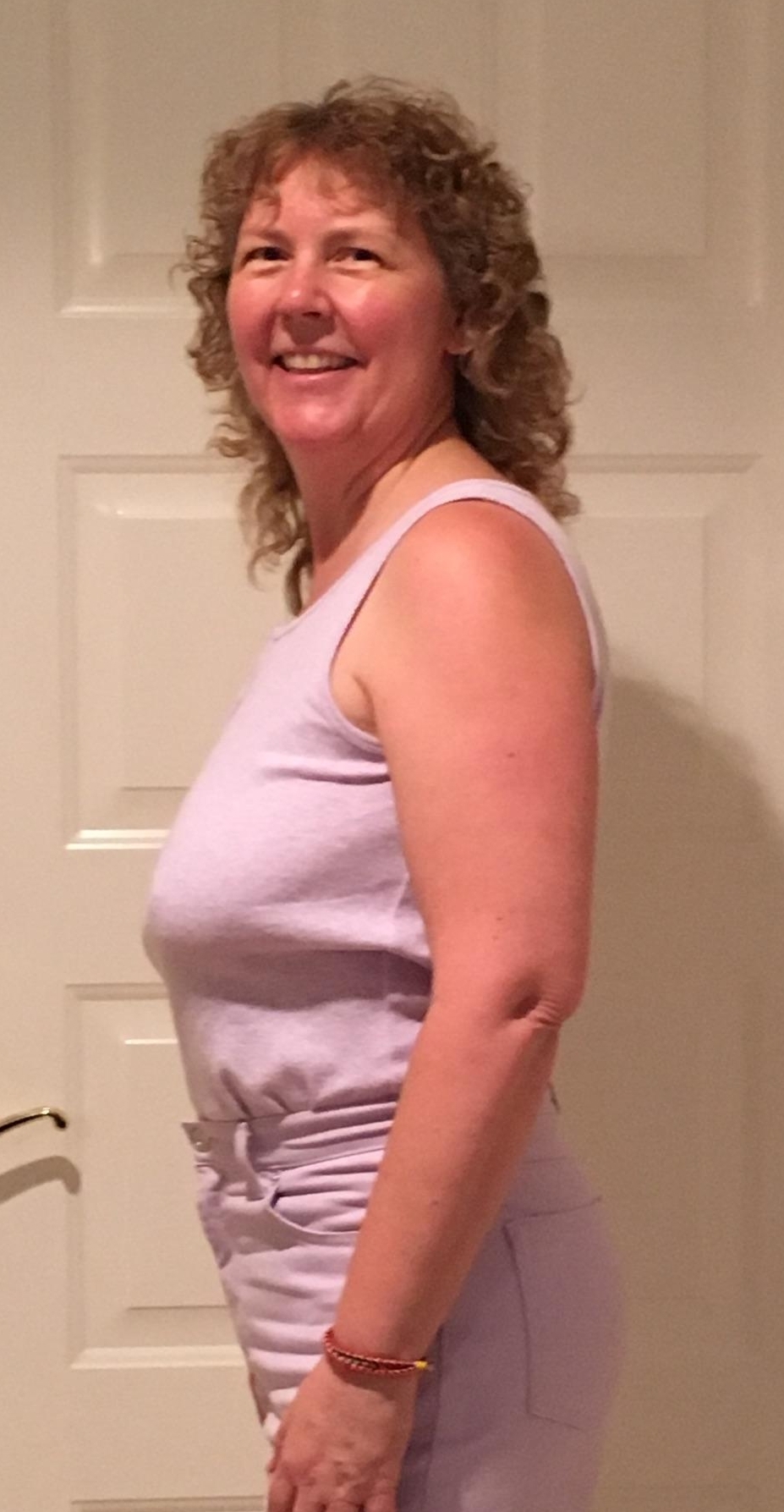 After 5 light treatments at Santa Barbara Light Therapy in conjunction with diet and exercise.