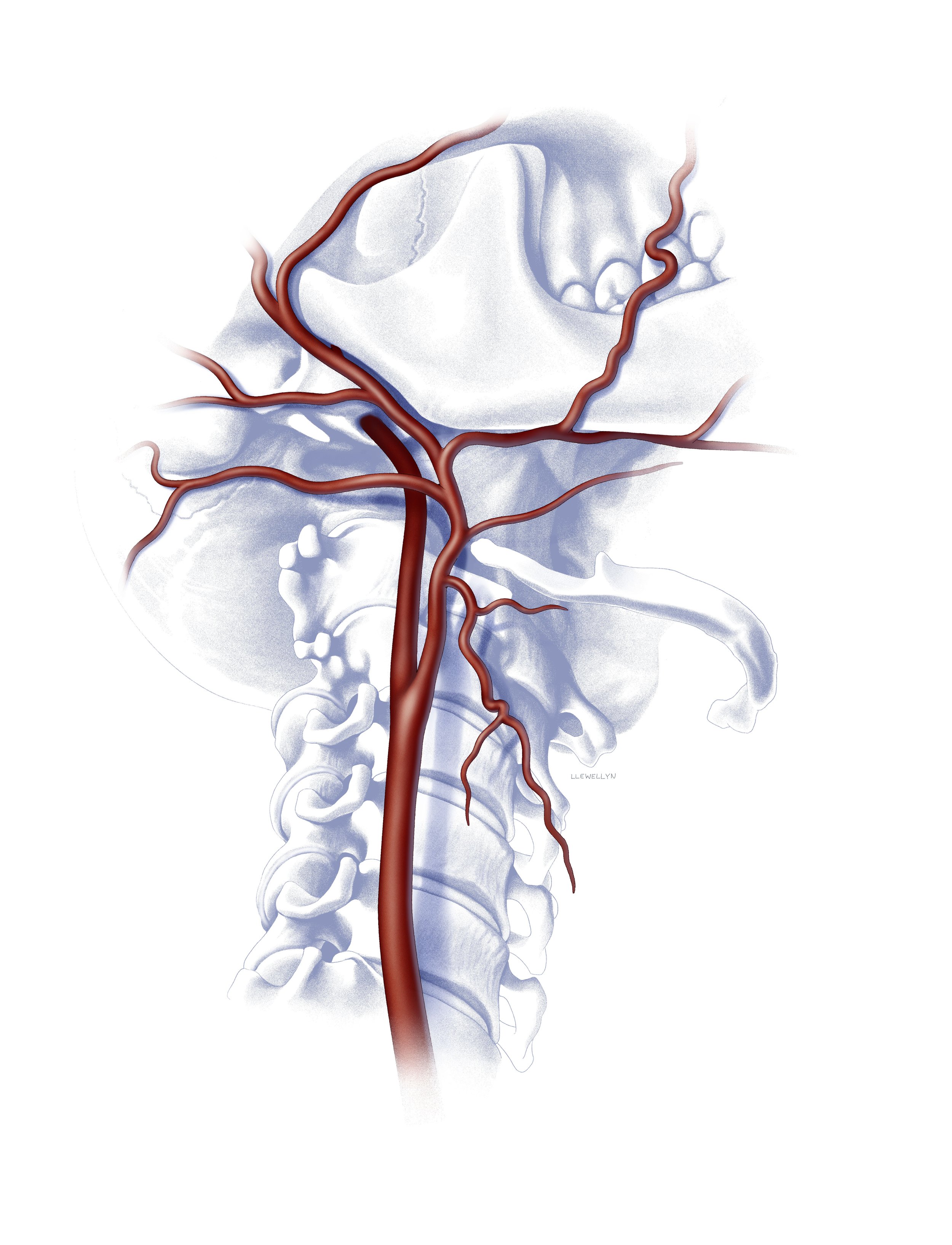 Carotid artery