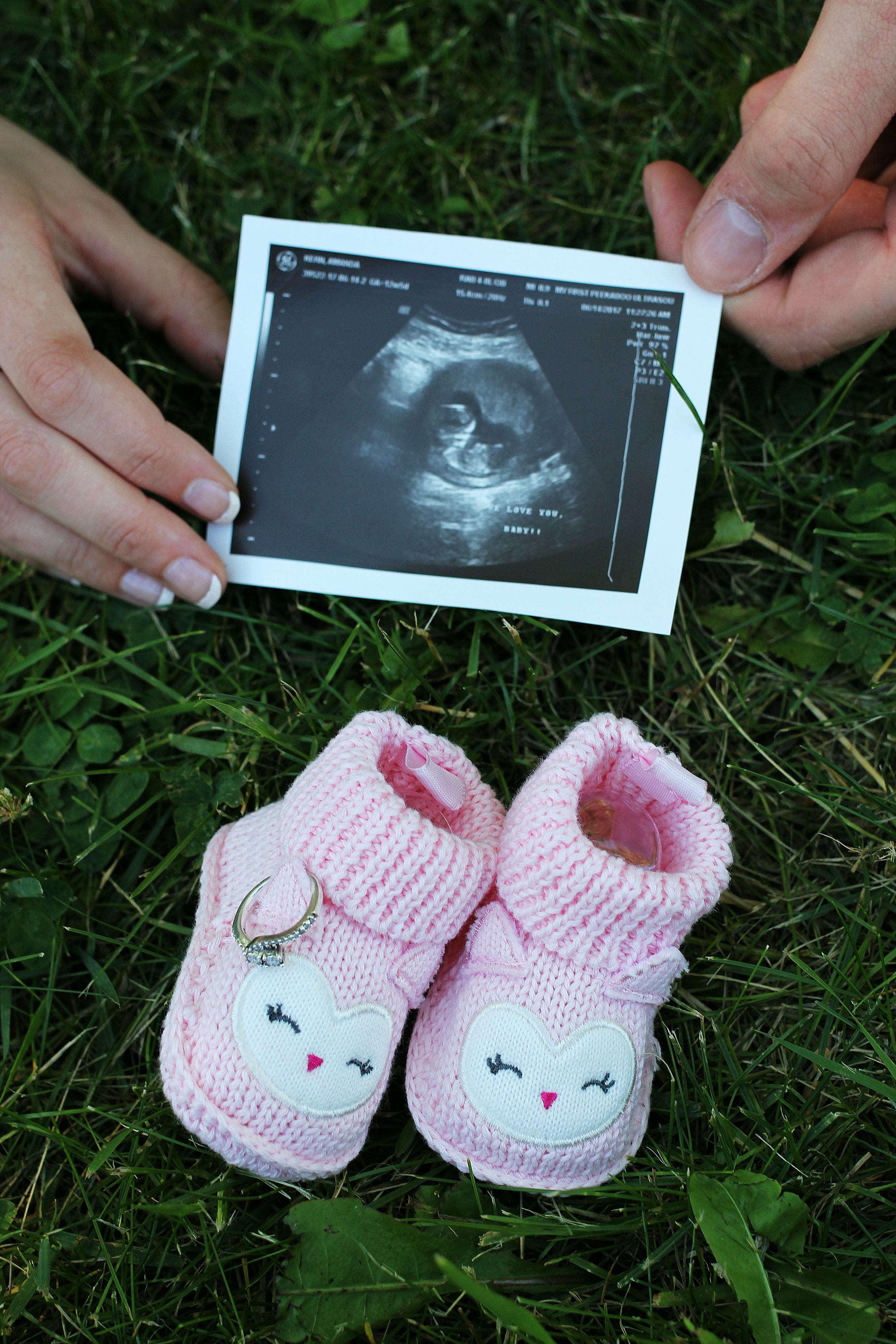 ©AKP Photography, LLC 2017