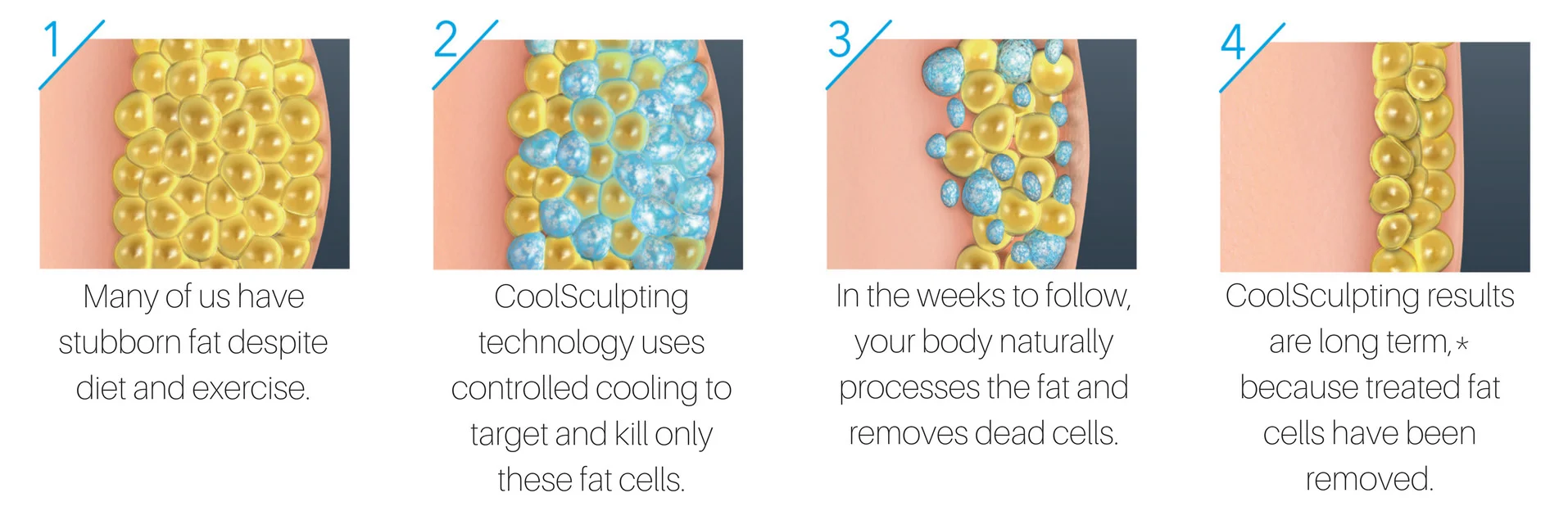 how-coolsculpting-works-web.jpg
