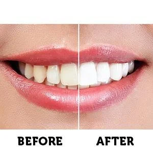 Smile Beautifully with Black Paste