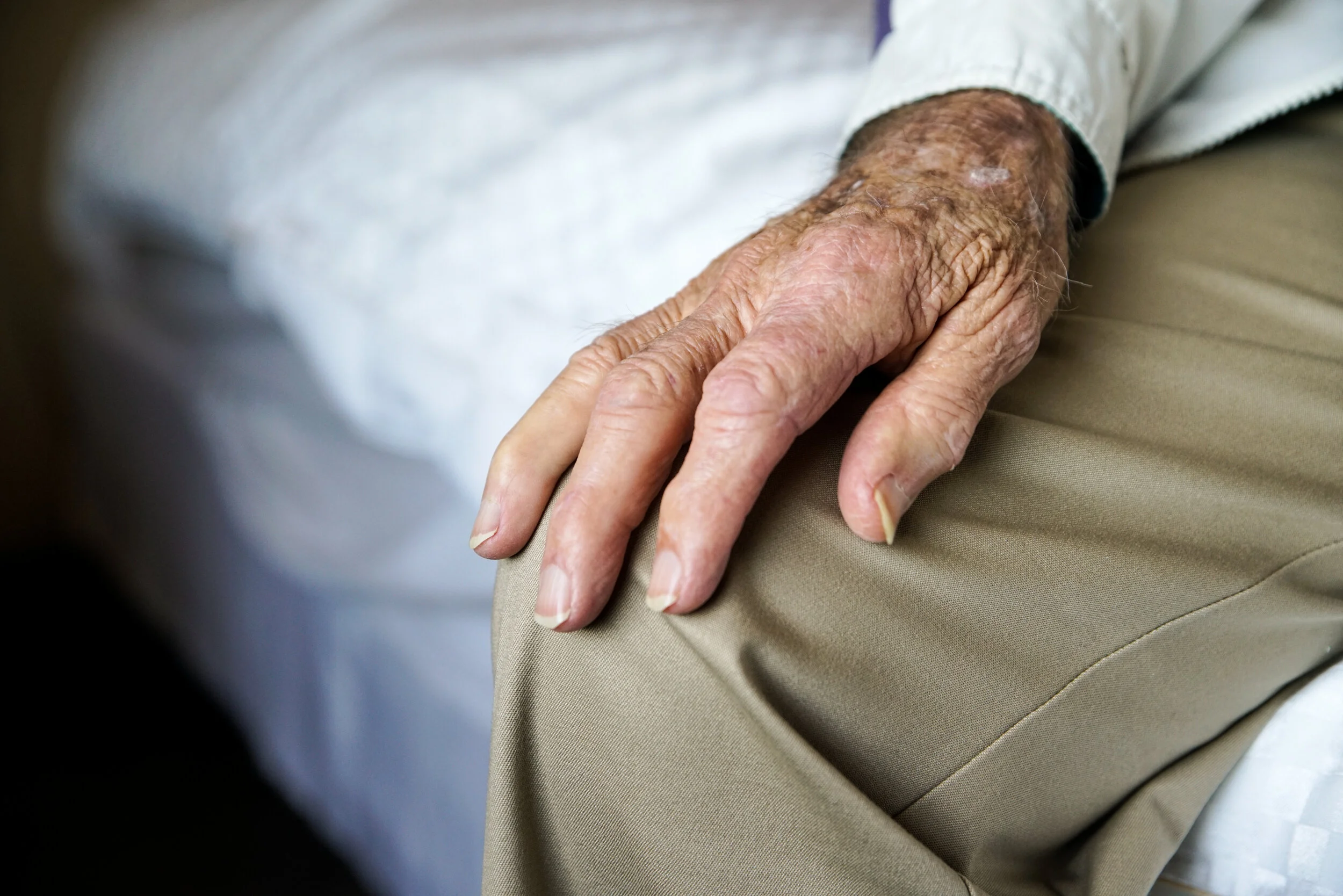 Norwood Hand close up.jpeg