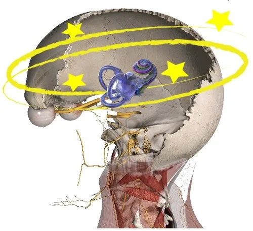 Cervicogenic Dizziness, Cervical Vertigo, Dizziness Cervical Spine, Physiotherapy, Physical Therapy, Harrison Vaughan, Danielle Vaughan