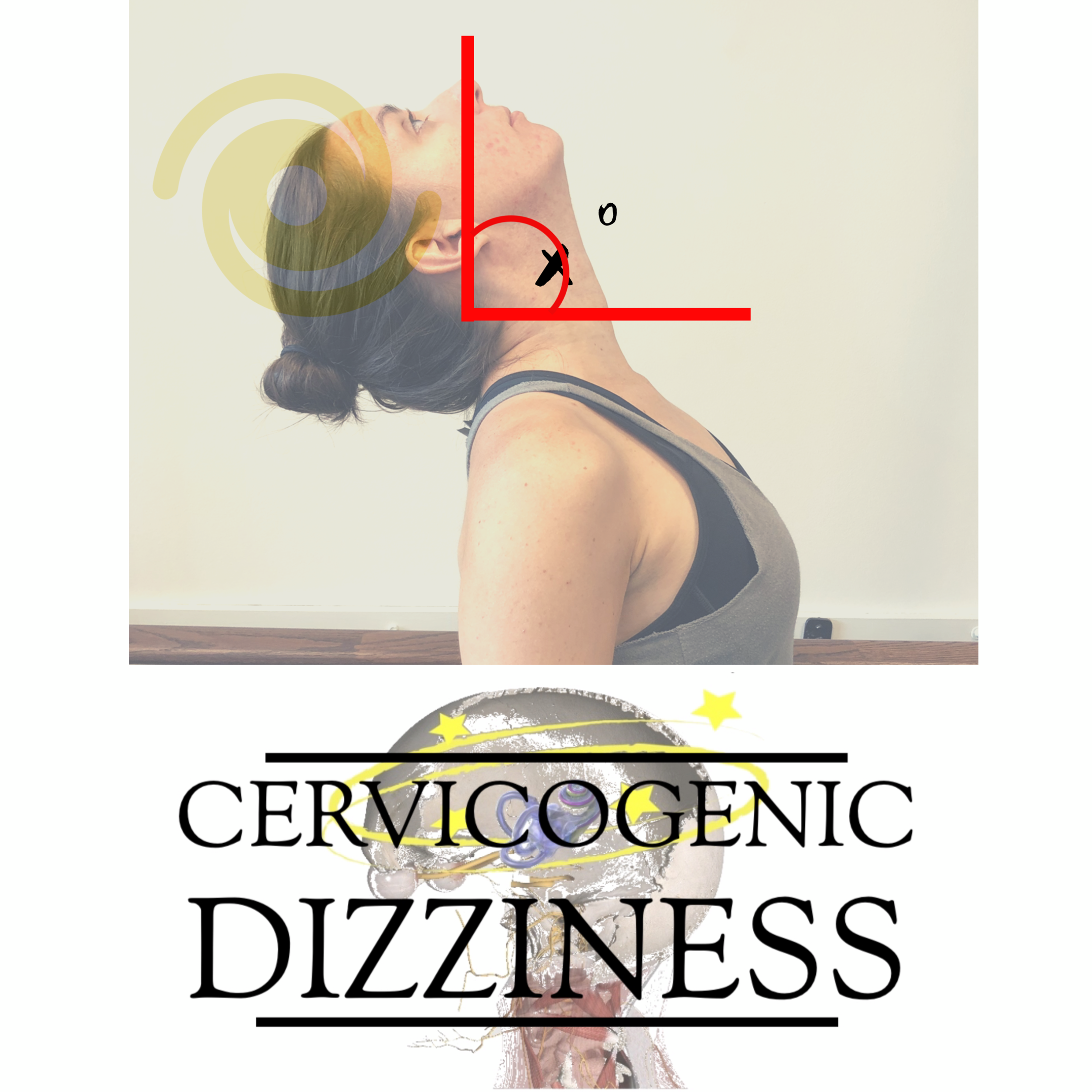 Cervicogenic Dizziness Diagnosis, Treatment and Course — Integrative