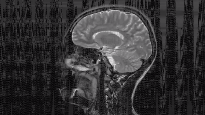 Here’s How Your Brain Can Learn To Be Less Racist
