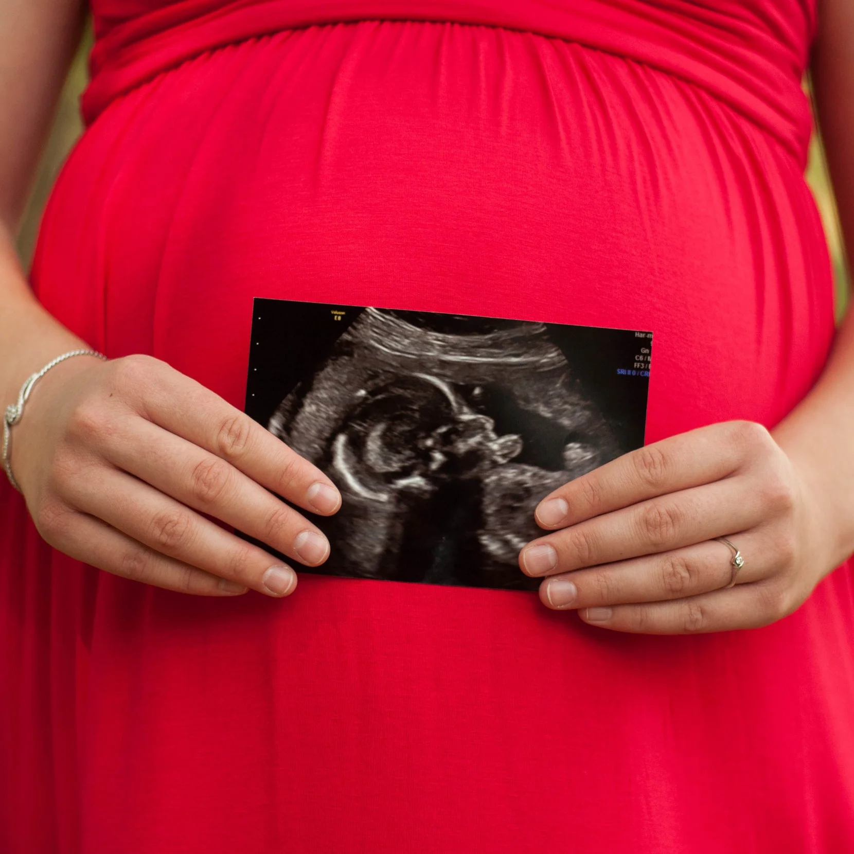 Maternity & Family Photos | Baby Number 2