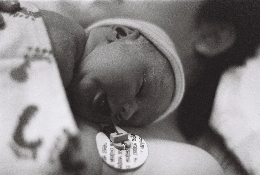 Amelia’s Birth Story Part 2: C-Section & Umbilical Cord Prolapse